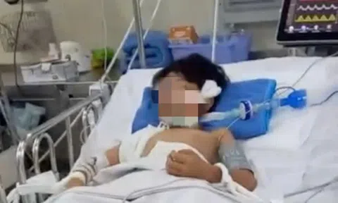 Dừng chờ đèn đỏ, bé trai 10 tuổi bị cành cây rơi trúng đầu dẫn tới nguy kịch