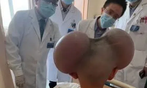 Cậu bé 3 tuổi với phần đầu lồi lên bất thường và sự thật đau lòng phía sau
