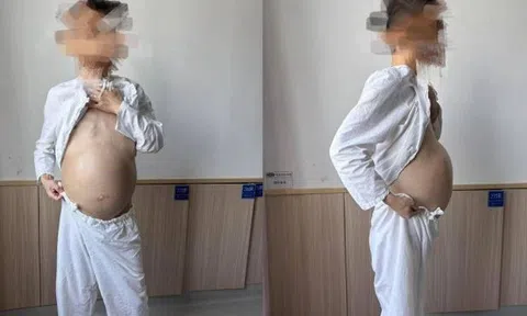 Người đàn ông 40 tuổi bụng to như mang bầu, khi phẫu thuật bác sĩ phát hiện điều đáng sợ