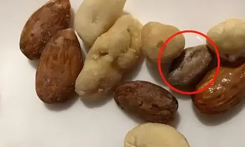 6 thực phẩm nhiều người nghĩ ăn được nhưng lại CÓ ĐỘC, bếp nhà nào cũng có