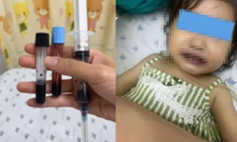 Ăn canh nấu bằng nước giếng, máu của bé gái 16 tuổi chuyển màu nâu đen