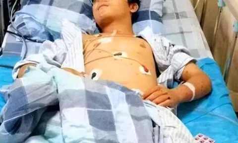 Chàng trai 17 tuổi suy thận giai đoạn cuối vì ăn quá nhiều 2 món nhưng vì "quá ngon" nên không ai từ chối
