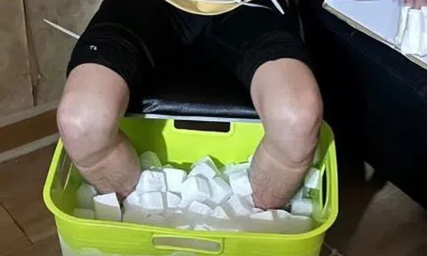 Nam sinh viên phải cắt cụt chân sau 10 tiếng ngâm đá khô, hé lộ âm mưu "động trời"