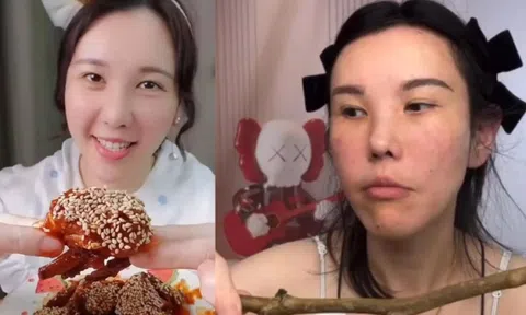 Mặt nữ mukbang biến dạng nghiêm trọng sau 2 năm hành nghề