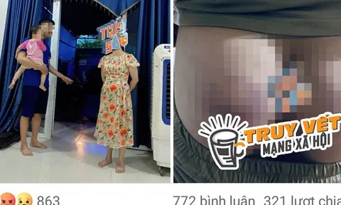 Công an xác minh thông tin cô giáo đánh học sinh bầm tím mông