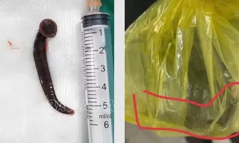 Người đàn ông gặp tai nạn hi hữu khi đang làm việc ngoài đồng
