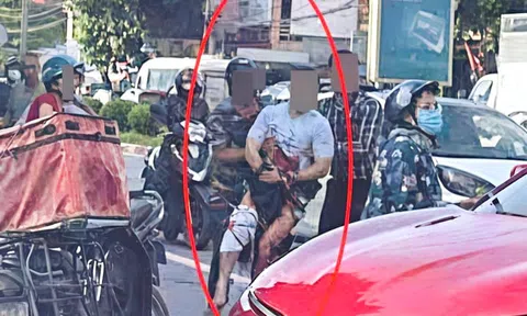 Nam TikToker ở Thái Nguyên bị chém gần đứt lìa bàn tay: Bác sĩ thông báo tin quan trọng