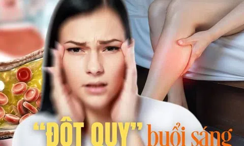 Sáng thức dậy mà gặp 6 dấu hiệu này ở đầu, coi chừng đột quỵ “đang tìm đến” bạn