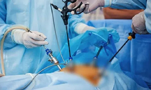 Người phụ nữ phải cắt bỏ túi mật từ triệu chứng buồn nôn, đau bụng