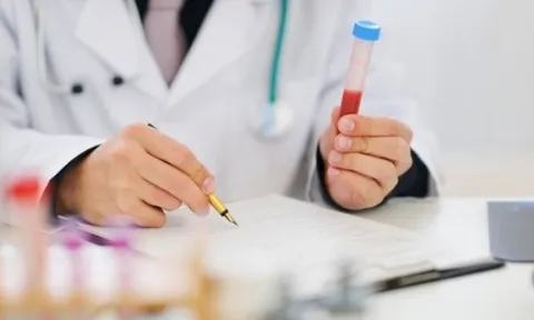 Mỡ máu tăng vọt dù không ăn dầu mỡ: Bác sĩ nói chính thói quen này là 'thủ phạm'