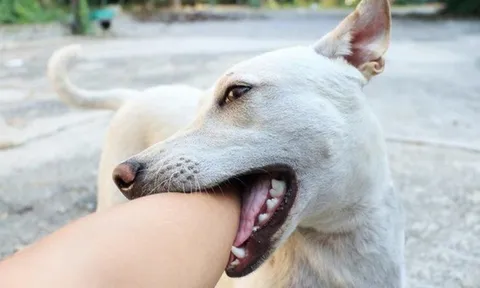Bé gái 11 tuổi không còn cơ hội sống sau vài ngày chó nuôi chết: Chuyên gia chỉ cách phòng tránh