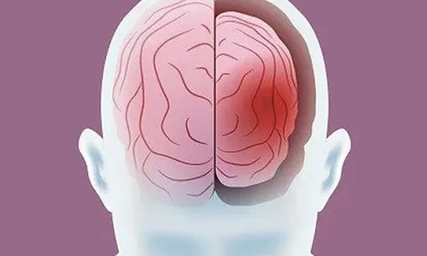 10 điều bộ não SỢ NHẤT: Có những hành vi dễ gây Alzheimer, teo não