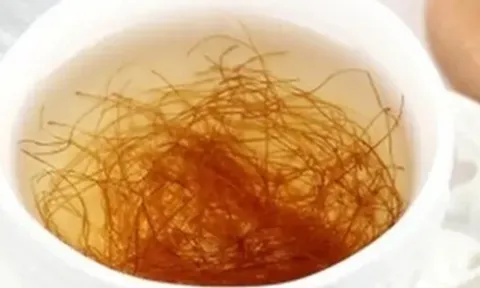 Thức khuya có hại gan không?