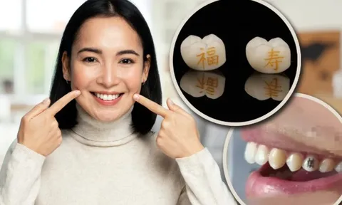 Sốc với mốt "xăm răng" ở Trung Quốc: Giới trẻ khắc chữ "làm giàu", "thành công" ngay trên răng