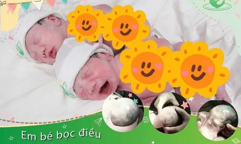 Ca sinh đôi hiếm gặp: Em bé chào đời vẫn còn nguyên vẹn trong "bọc diều"