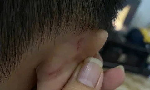 Giáo viên bị xử phạt vì bạo hành trẻ, phụ huynh đòi hoàn lại 1 năm học phí