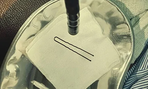 Bé gái 4 tuổi đột ngột khóc thét, vào viện bác sĩ gắp ra thứ "đáng sợ" bên trong