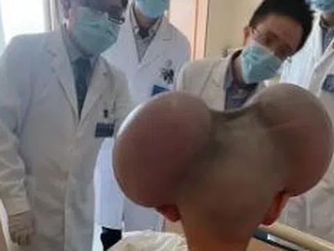 Cậu bé 3 tuổi với phần đầu lồi lên bất thường và sự thật đau lòng phía sau