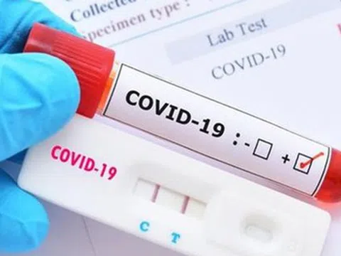 NÓNG: 83% mẫu COVID-19 tại TP HCM là biến chủng mới NB.1.8.1