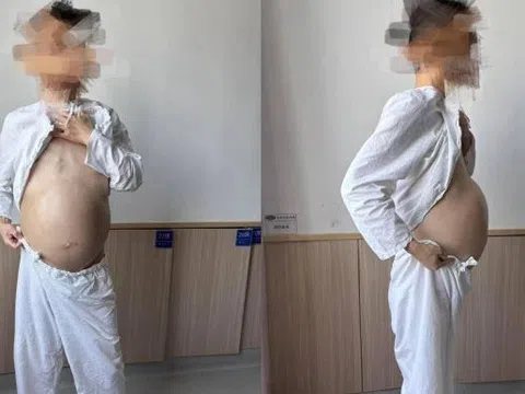 Người đàn ông 40 tuổi bụng to như mang bầu, khi phẫu thuật bác sĩ phát hiện điều đáng sợ