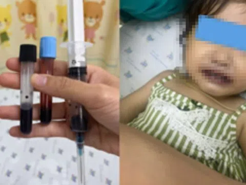 Ăn canh nấu bằng nước giếng, máu của bé gái 16 tuổi chuyển màu nâu đen