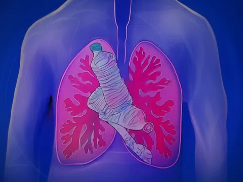 Ngồi không cũng nhiễm vi nhựa - Chuyên gia cảnh báo ô nhiễm vi nhựa trong không khí, con người có thể hít vào lượng vi nhựa to bằng hươu cao cổ