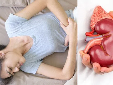 Cô gái trẻ 18 tuổi đã bị hỏng thận vì 3 kiểu ăn uống thường gặp ở người trẻ: BS khuyên làm ngay 4 việc để để bảo vệ "nhà máy lọc máu" của cơ thể