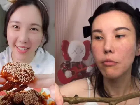 Mặt nữ mukbang biến dạng nghiêm trọng sau 2 năm hành nghề