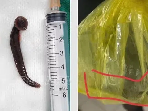 Người đàn ông gặp tai nạn hi hữu khi đang làm việc ngoài đồng