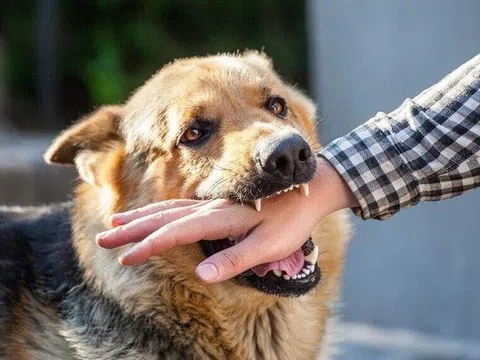 Bé trai ở Đắk Lắk bị chó cắn nhiều lần nhưng không tiêm phòng, tử vong nghi do bệnh dại