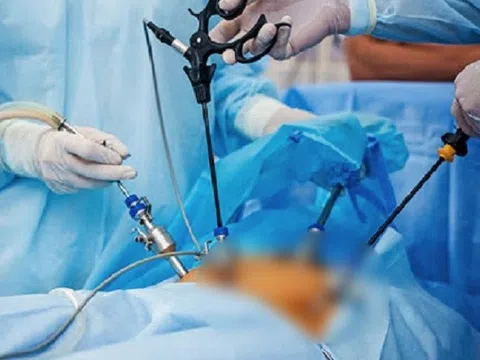 Người phụ nữ phải cắt bỏ túi mật từ triệu chứng buồn nôn, đau bụng
