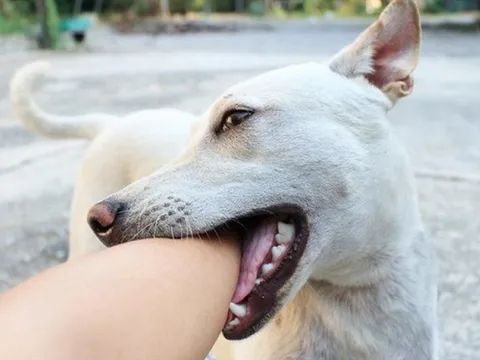 Bé gái 11 tuổi không còn cơ hội sống sau vài ngày chó nuôi chết: Chuyên gia chỉ cách phòng tránh