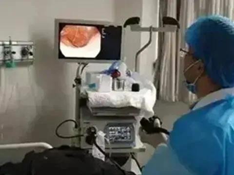 Người đàn ông qua đời vì ung thư đại tràng dù ngủ sớm, dậy sớm, thích đi bộ, bác sĩ lắc đầu: 4 thực phẩm yêu thích của nhiều người là nguyên nhân