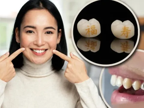 Sốc với mốt "xăm răng" ở Trung Quốc: Giới trẻ khắc chữ "làm giàu", "thành công" ngay trên răng