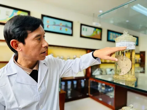 Món "khoái khẩu" của không ít người Việt có thể gây tổn thương gan, thậm chí ung thư